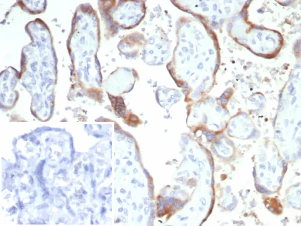 SDS-PAGE Analysis of Purified CD21 Mouse Monoclonal Antibody (rCR2/6964). Confirmation of Purity and Integrity of Antibody.