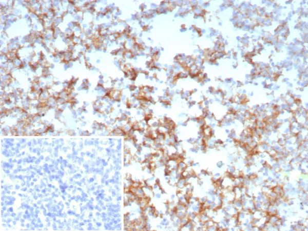 Formalin-fixed, paraffin-embedded human tonsil stained with CD21 Recombinant Rabbit Monoclonal Antibody (CR2/8769R). Inset: PBS instead of primary antibody; secondary only negative control.