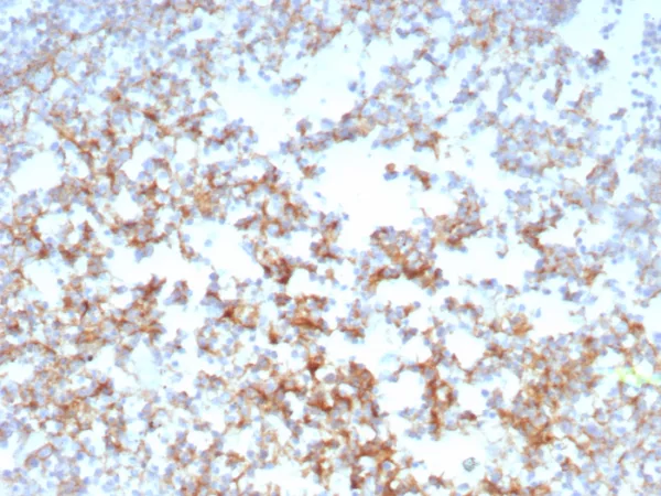 Formalin-fixed, paraffin-embedded human tonsil stained with CD21 Recombinant Rabbit Monoclonal Antibody (CR2/8769R). HIER: Tris/EDTA, pH9.0, 45min. 2: HRP-polymer, 30min. DAB, 5min.