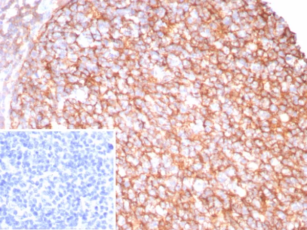 Recombinant CD21 (Mature B-Cell & Follicular Dendritic Cell Marker) Antibody