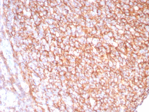 Recombinant CD21 (Mature B-Cell & Follicular Dendritic Cell Marker) Antibody - Image 2