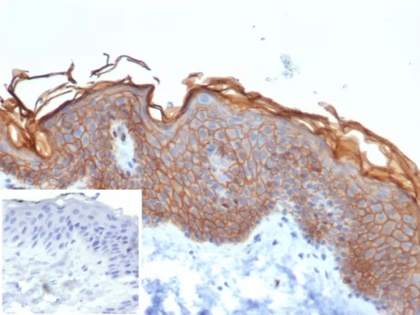 Formalin-fixed, paraffin-embedded human skin stained with S100A16 Mouse Monoclonal Antibody (S100A16/7412). Inset: PBS instead of primary antibody; secondary only negative control.