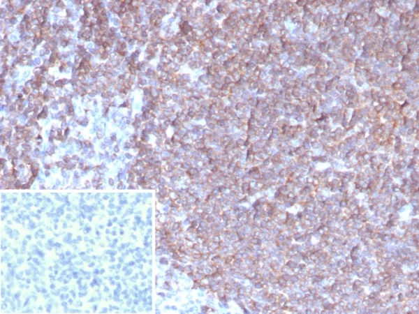 Formalin-fixed, paraffin-embedded human tonsil stained with G-CSF Mouse Monoclonal Antibody (CSF3/4597).  Inset: PBS instead of primary antibody; secondary only negative control.