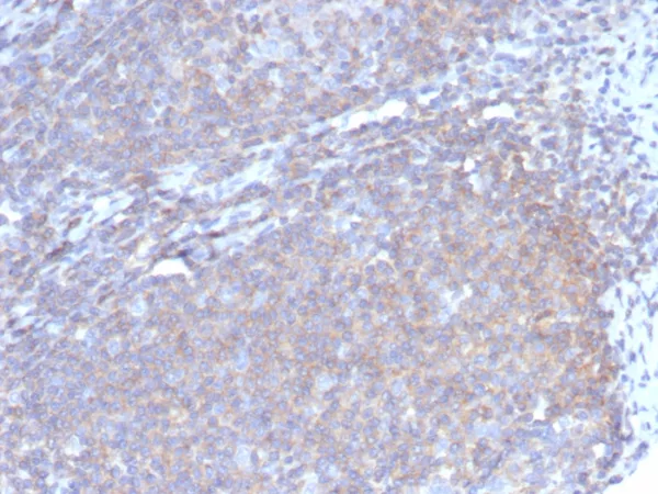 Formalin-fixed, paraffin-embedded human lymph node stained with G-CSF Mouse Monoclonal Antibody (CSF3/4597). HIER: Tris/EDTA, pH9.0, 45min. 2°C: HRP-polymer, 30min. DAB, 5min.