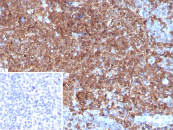 Granulocyte-Colony Stimulating Factor (G-CSF) Antibody