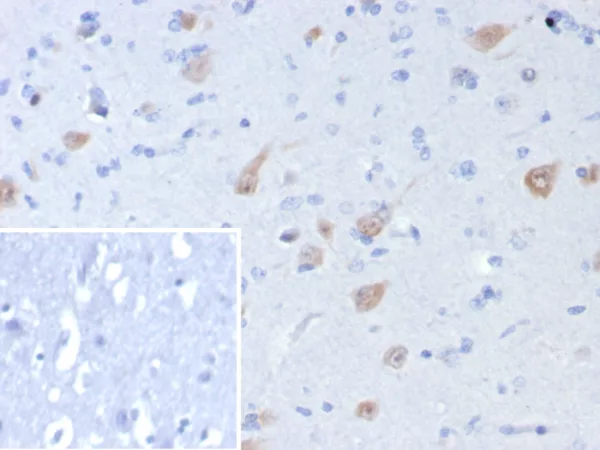 Formalin-fixed, paraffin-embedded human brain stained with NeuN Recombinant Mouse Monoclonal Antibody (rNEUN/8055). Inset: PBS instead of primary antibody; secondary only negative control.