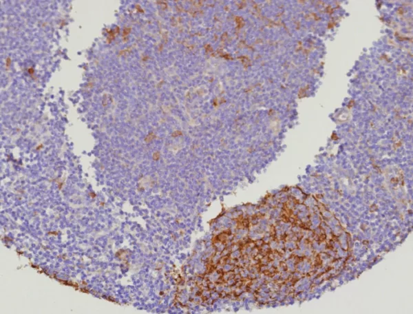 Recombinant Cystatin A Antibody