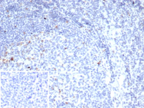 Formalin-fixed, paraffin-embedded human tonsil stained with CTLA4 Recombinant Mouse Monoclonal Antibody (rCTLA4/7219). Inset: PBS instead of primary antibody; secondary only negative control.