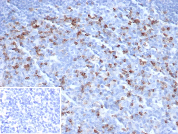 Formalin-fixed, paraffin-embedded human tonsil stained with CTLA4 Recombinant Rabbit Monoclonal Antibody (CTLA4/6864R). Inset: PBS instead of primary antibody; secondary only negative control.