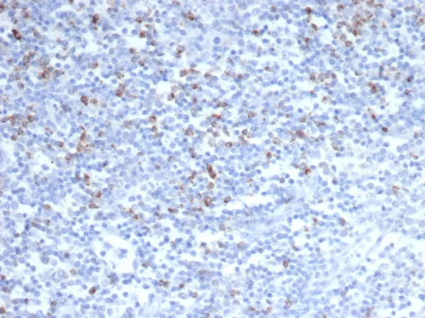 Formalin-fixed, paraffin-embedded human tonsil stained with CTLA4 Recombinant Rabbit Monoclonal Antibody (CTLA4/6864R). HIER: Tris/EDTA, pH9.0, 45min. 2°C: HRP-polymer, 30min. DAB, 5min