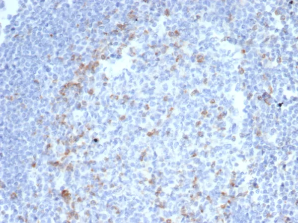 Formalin-fixed, paraffin-embedded human tonsil stained with CTLA4 Recombinant Rabbit Monoclonal Antibody (CTLA4/6867R). HIER: Tris/EDTA, pH9.0, 45min. 2°C: HRP-polymer, 30min. DAB, 5min