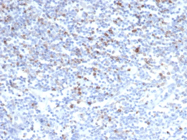 Formalin-fixed, paraffin-embedded human tonsil stained with CTLA4 Recombinant Rabbit Monoclonal Antibody (CTLA4/6868R). HIER: Tris/EDTA, pH9.0, 45min. 2°C: HRP-polymer, 30min. DAB, 5min