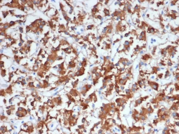 Formalin-fixed, paraffin-embedded human adrenal gland stained with Dopamine Beta-Hydroxylase Mouse Monoclonal Antibody (DBH/7224). HIER: Tris/EDTA, pH9.0, 45min. 2°C: HRP-polymer, 30min. DAB, 5min.