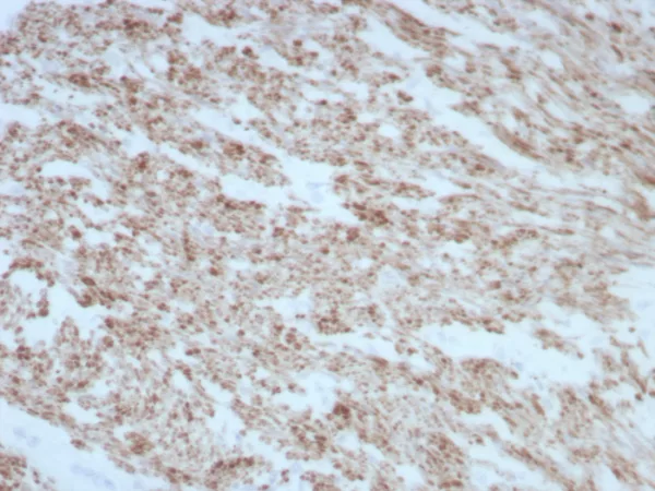 Formalin-fixed, paraffin-embedded human smooth muscle stained with Desmin Recombinant Mouse Monoclonal Antibody (rDES/8846). HIER: Tris/EDTA, pH9.0, 45min. 2°C: HRP-polymer, 30min. DAB, 5min.