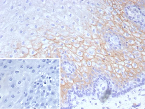 Desmocollin-2/3 Antibody in Immunohistochemistry (IHC (P))