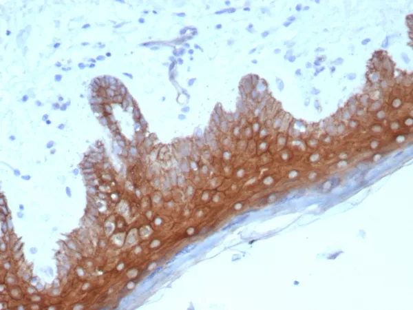 Formalin-fixed, paraffin-embedded human skin stained with Desmoglein-1 Recombinant Rabbit Monoclonal Antibody (DSG1/8576R).