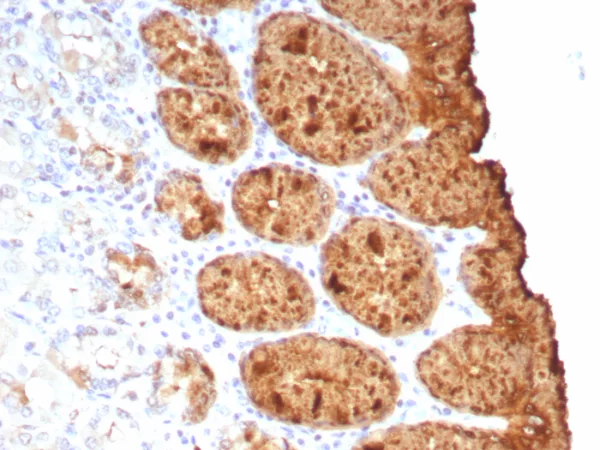 Formalin-fixed, paraffin-embedded human colon stained with TAG-72 Recombinant Mouse Monoclonal Antibody (rTAG72/9132). HIER: Tris/EDTA, pH9.0, 45min. 2°C: HRP-polymer, 30min. DAB, 5min.