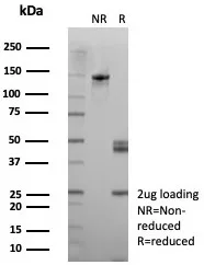 SDS-PAGE Analysis of Purified Desmoglein-3 Recombinant Mouse Monoclonal Antibody (rDSG3/8611). Confirmation of Integrity and Purity of Antibody.