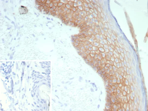 Recombinant Desmoglein-3 (Squamous Cell Marker) Antibody - Image 2