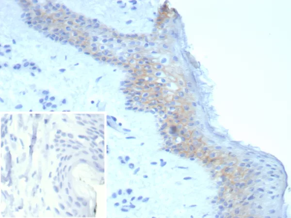 Formalin-fixed, paraffin-embedded human skin stained with Desmoglein-3 Recombinant Rabbit Monoclonal Antibody (DSG3/8251R). Inset: PBS instead of primary antibody; secondary only negative control.