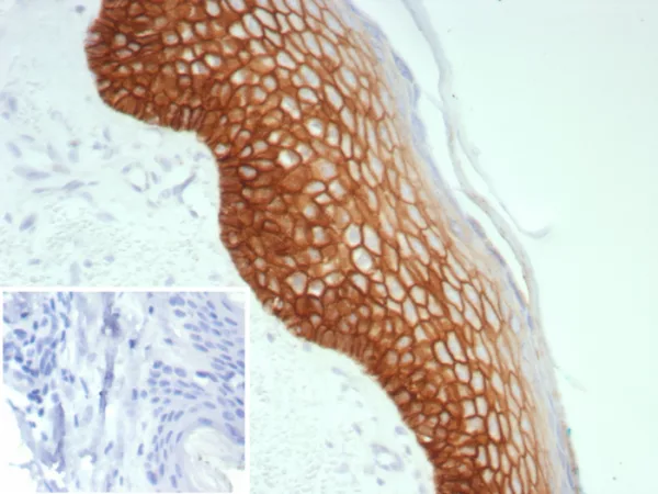 Formalin-fixed, paraffin-embedded human skin stained with Desmoglein-3 Recombinant Rabbit Monoclonal Antibody (DSG3/8613R). Inset: PBS instead of primary antibody; secondary only negative control.