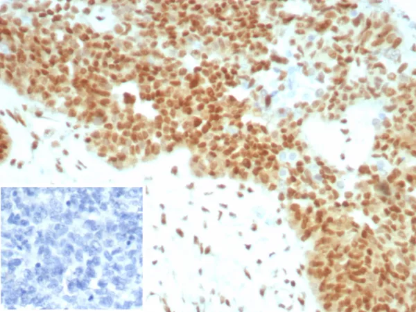 Recombinant E2F4 (Transcription Factor) Antibody