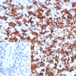 Formalin-fixed, paraffin-embedded human spleen stained with AIF1 / Iba1 Recombinant Rabbit Monoclonal Antibody (AIF1/8970R). Inset: PBS instead of primary antibody; secondary only negative control.