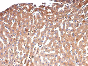 Alpha-2-Macroglobulin Antibody in Immunohistochemistry (IHC (P))