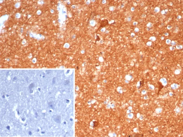 NSE gamma (Neuron Specific Enolase, gamma) (Neuroendocrine Marker) Antibody