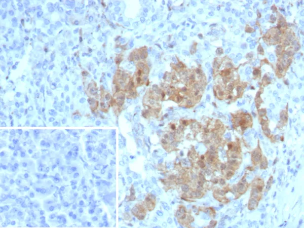 Formalin-fixed, paraffin-embedded human pancreas stained with NSE gamma Recombinant Rabbit Monoclonal Antibody (ENO/8253R). Inset: PBS instead of primary antibody; secondary only negative control.