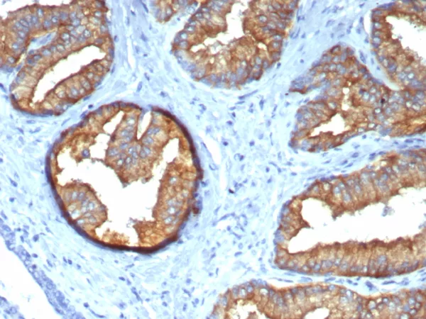 Formalin-fixed, paraffin-embedded prostate stained with Tubulin beta 3 Mouse Monoclonal Antibody (TUBB/4470).