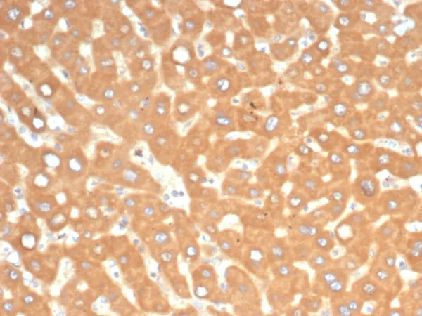 Formalin-fixed, paraffin-embedded human liver in colon stained with EPH Receptor B4 (EPHB4) Mouse Monoclonal Antibody (EPHB4/6391). HIER: Tris/EDTA, pH9.0, 45min. 2°C: HRP-polymer, 30min. DAB, 5min.