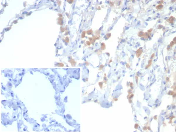 Formalin-fixed, paraffin-embedded human lung stained with EPH Receptor B4 (EPHB4) Mouse Monoclonal Antibody (EPHB4/6392). Inset: PBS instead of primary antibody; secondary only negative control.