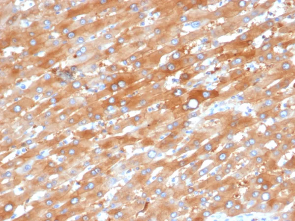 Formalin-fixed, paraffin-embedded human liver in colon stained with EPH Receptor B4 (EPHB4) Mouse Monoclonal Antibody (EPHB4/6392). HIER: Tris/EDTA, pH9.0, 45min. 2°C: HRP-polymer, 30min. DAB, 5min.