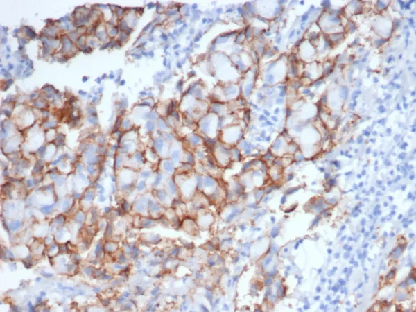 HER-2 Antibody in Immunohistochemistry (IHC (P))