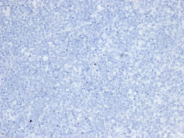 IHC analysis of formalin-fixed, paraffin-embedded human brain.  Negative tissue control using ERBB2/6637 at 2ug/ml in PBS for 30min RT. HIER: Tris/EDTA, pH9.0, 45min. 2°C: HRP-polymer, 30min. DAB, 5min.