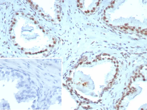 ERCC1 / RAD10 (Tumor Progression Marker) Antibody