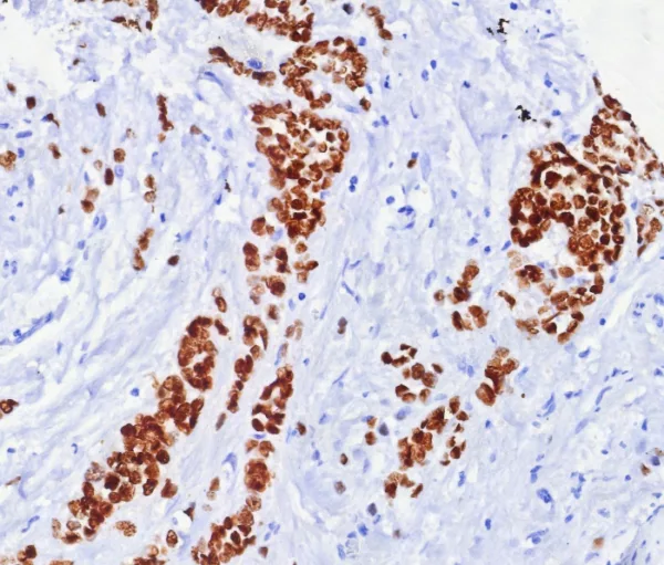 Recombinant Estrogen Receptor, alpha (Marker of Estrogen Dependence) Antibody