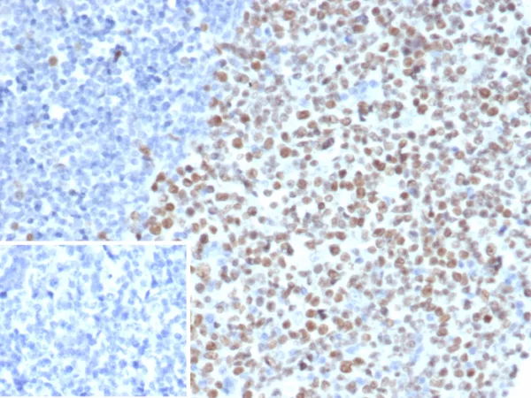 EZH2 / KMT6 Antibody