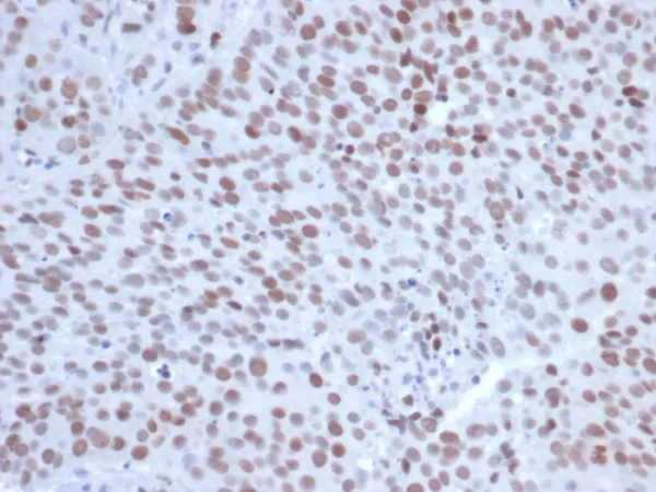 EZH2 / KMT6 Antibody - Image 2