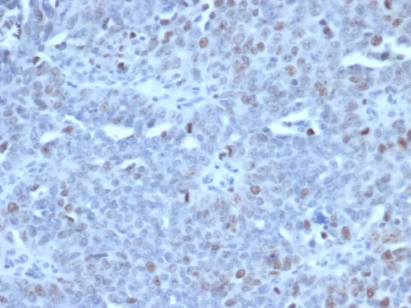 EZH2 / KMT6 Antibody