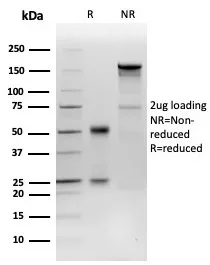 SDS-PAGE Analysis  Purified Coagulation Factor VII Mouse Monoclonal Antibody (F7/3515). Confirmation of Integrity and Purity of Antibody.