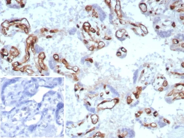 IHC analysis of formalin-fixed, paraffin-embedded human placenta.  Stained using rFABP4/8536 at 2ug/ml in PBS for 30min RT. Inset: PBS instead of primary antibody; secondary only negative control.