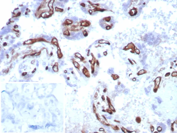 IHC analysis of formalin-fixed, paraffin-embedded human placenta.  Stained using FABP4/8537R at 2ug/ml in PBS for 30min RT. Inset: PBS instead of primary antibody; secondary only negative control.