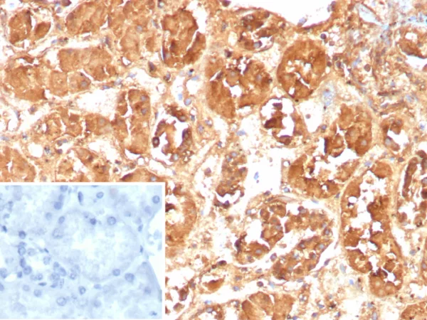 Formalin-fixed, paraffin-embedded human kidney stained with FABP1 Mouse Monoclonal Antibody (FABP1/4517). HIER: Tris/EDTA, pH9.0, 45min. 2°C: HRP-polymer, 30min. DAB, 5min.