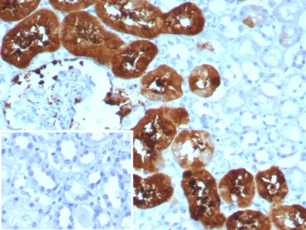 Formalin-fixed, paraffin-embedded human kidney stained with FABP1 Recombinant Rabbit Monoclonal Antibody (FABP1/8521R). Inset: PBS instead of primary antibody; secondary only negative control.