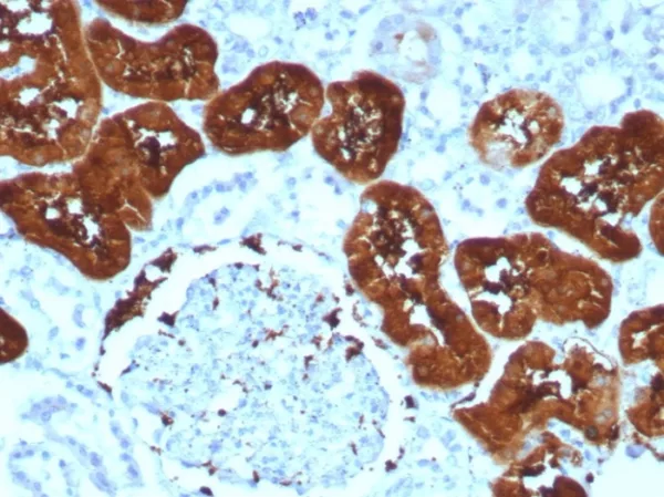 Formalin-fixed, paraffin-embedded human kidney stained with FABP1 Recombinant Rabbit Monoclonal Antibody (FABP1/8521R). HIER: Tris/EDTA, pH9.0, 45min. 2: HRP-polymer, 30min. DAB, 5min.