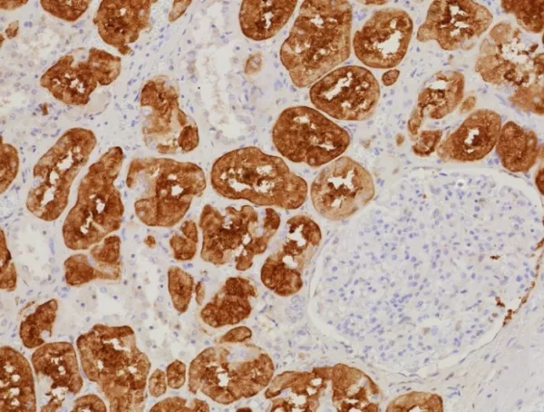 Formalin-fixed, paraffin-embedded human kidney stained with FABP1 Recombinant Rabbit Monoclonal Antibody (FABP1/9085R). Inset: PBS instead of primary antibody; secondary only negative control.