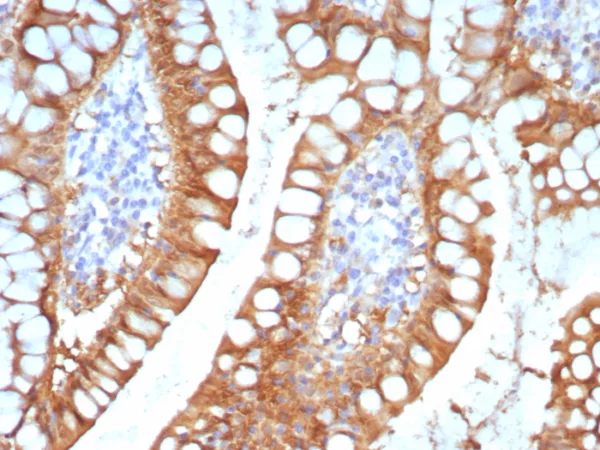 Formalin-fixed, paraffin-embedded human small intestine stained with FABP2 Mouse Monoclonal Antibody (FABP2/7670). HIER: Tris/EDTA, pH9.0, 45min. 2: HRP-polymer, 30min. DAB, 5min.