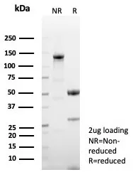 SDS-PAGE Analysis of Purified CD23 Recombinant Rabbit Monoclonal Antibody (FCER2/8509R). Confirmation of Purity and Integrity of Antibody.